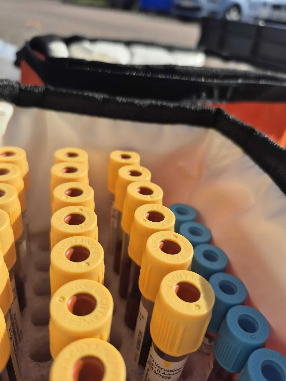 Saccoche prélèvement